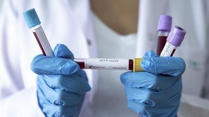 Украинцы массово сдают тесты на коронавирус