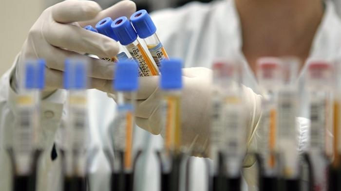 Ученые разработали анализ крови, который выявляет 50 видов рака