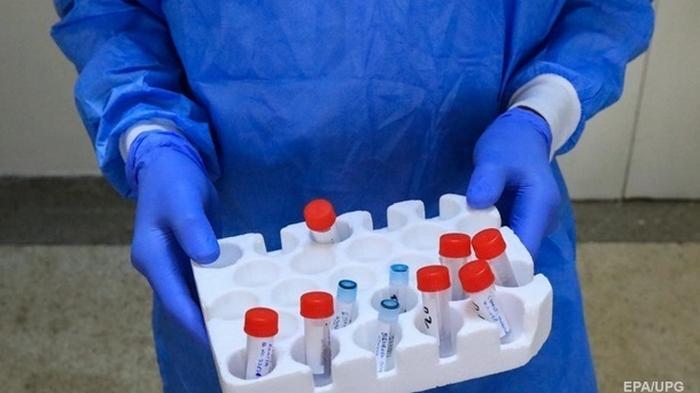 В Нежине лабораторный центр закрылся из-за коронавируса
