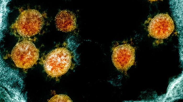 Живучесть. Частички коронавируса под микроскопом при 22 и 34 градусах по Цельсию – фото