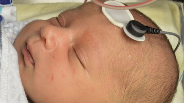 Ученые предложили новый метод для диагностики аутизма у новорожденных