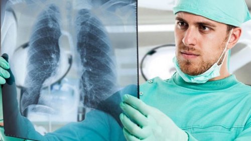 Власти намерены преодолеть эпидемию туберкулеза в Украине до 2030 года