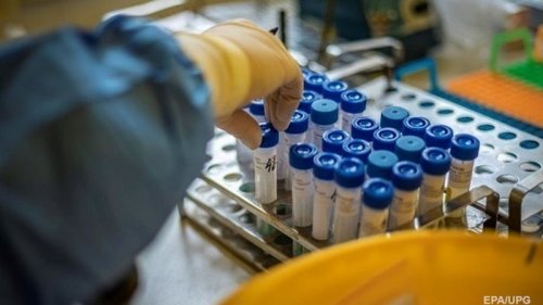 Сотрудница института биотехнологий в Киеве похитила опасные штаммы вируса