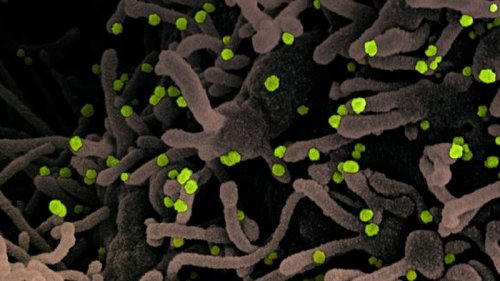 Альфа-штамм коронавируса научился тормозить врожденный иммунитет: что выяснили биологи