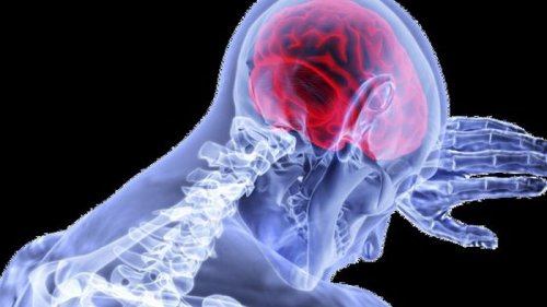 Ученые создали мозговой имплант, который обнаруживает и устраняет боль в реальном времени