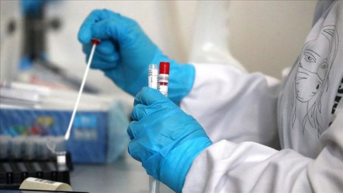 ВОЗ передала Украине 2 тыс. тестов для определения штамма коронавируса Дельта