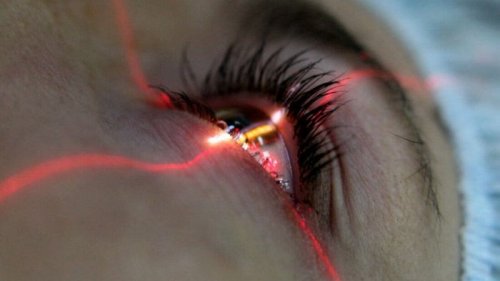 Лазерная коррекция — эффективный способ восстановить зрение