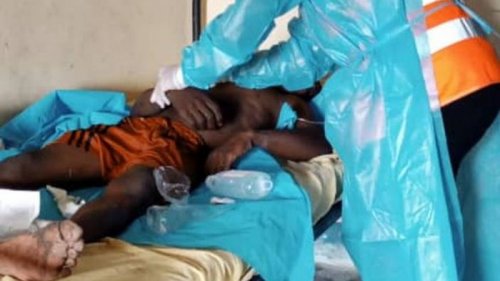 В Камеруне началась вспышка холеры
