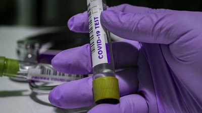 В Нидерландах не хватает COVID-тестов из-за вспышки заболевания