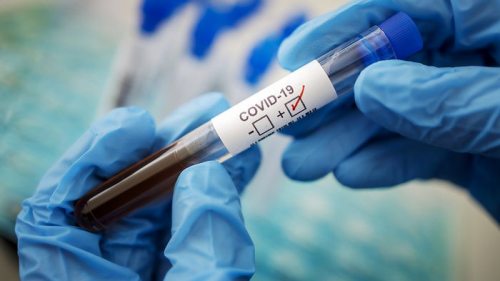 В ВОЗ усомнились в самоликвидации дельта-штамма коронавируса