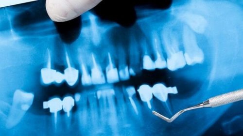 Частная стоматология доктора Колоса – эффективная и своевременная помо