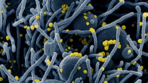 Инфицирование омикроном, возможно, дает защиту и от дельта-коронавируса