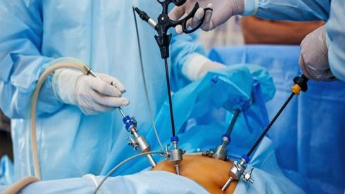Почему операцию при варикоцеле стоит делать в хирургической клинике Ga