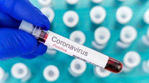 Коронавирусом в мире заболело более 363 млн человек