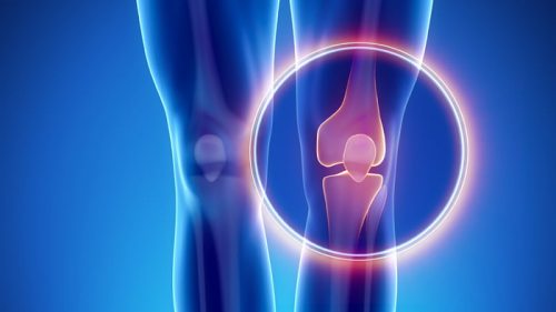 Артроз коленного сустава: симптомы, диагностика, лечение