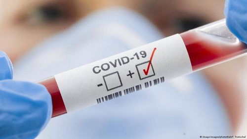 Названы сроки пика коронавируса в Украине
