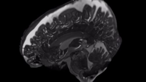 Ученые показали изнутри, как работает человеческий мозг (видео)