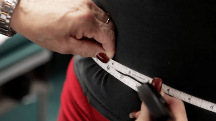 Ученые назвали, сколько лет жизни потеряло человечество из-за ожирения: сумма впечатляет