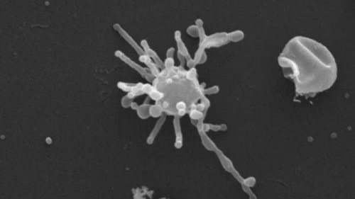 Микроб со щупальцами может быть прямым предком всей сложной жизни на Земле: что выяснили ученые