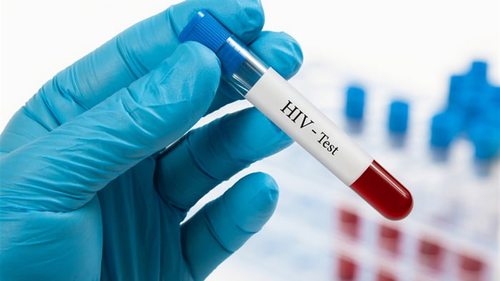 Аналіз крові на ВІЛ