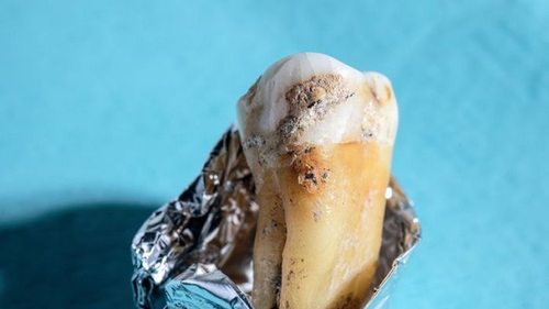 Нашли в зубном налете неандертальцев: ученым удалось воскресить древнюю бактерию