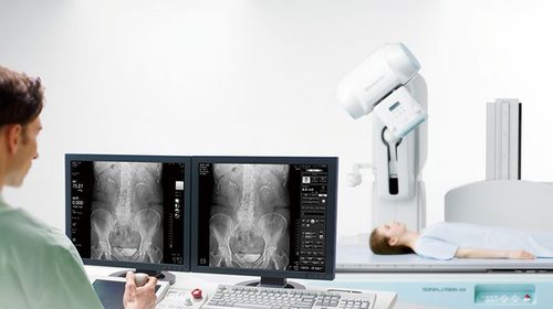 Какие преимущества имеет цифровой рентген аппарат и оцифровщик рентгеновских снимков