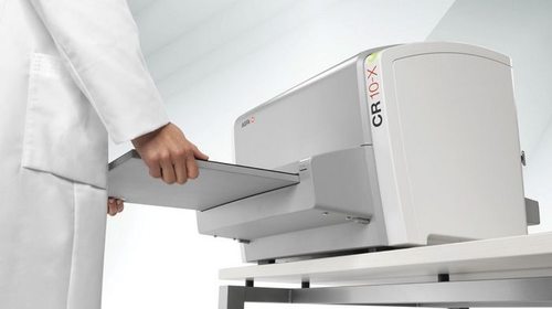 Какие преимущества имеет цифровой рентген аппарат и зачем нужен оцифро