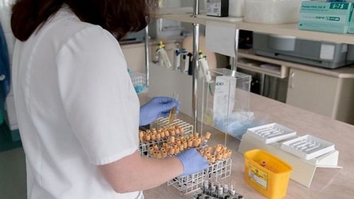 В Винницкой области резко возросло количество больных гепатитом А - МОЗ