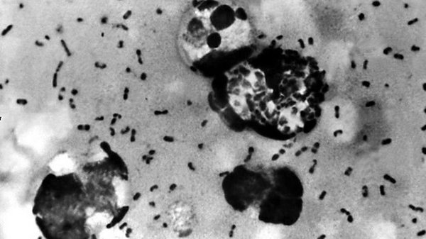 В США обнаружили первый случай бубонной чумы за 10 лет