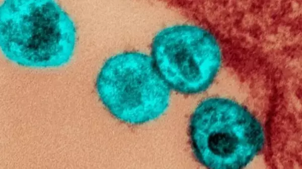 Вакцина против ВИЧ: препарат впервые выработал мощные антитела