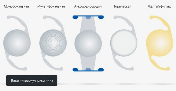 интраокулярные линзы и их типы