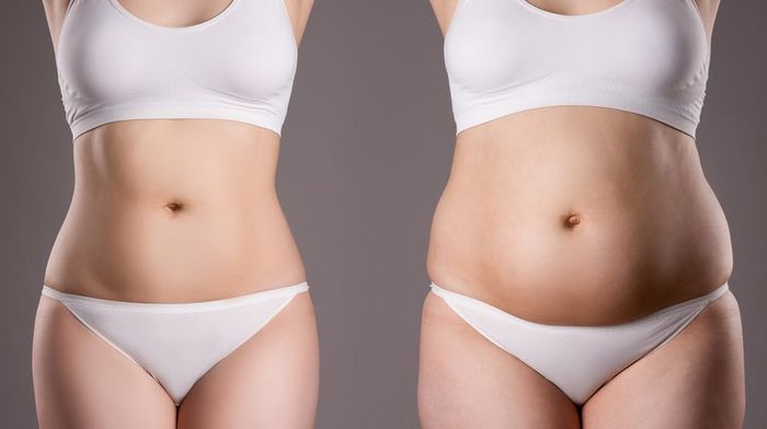 Абдоминопластика: талия без усилий