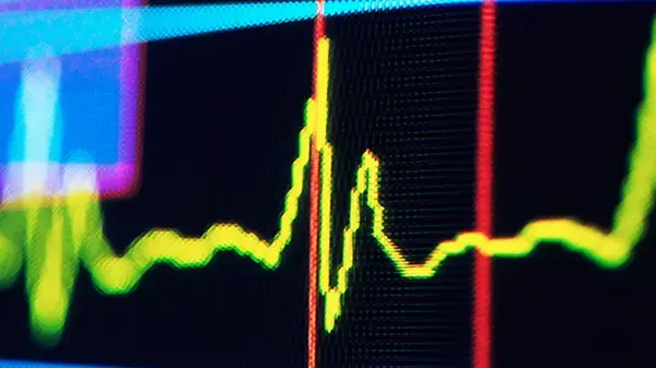 Ритм пульса человека может сигнализировать о будущем когнитивном ухудшении