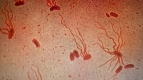 «Гнилая горячка» возвращается из прошлого: у нас почти не осталось антибиотиков от брюшного тифа