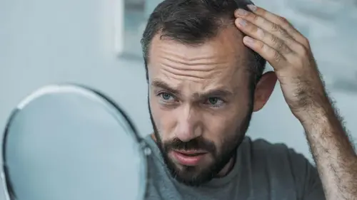 Важно, где именно вы лысеете: что линия волос может рассказать о вашем здоровье